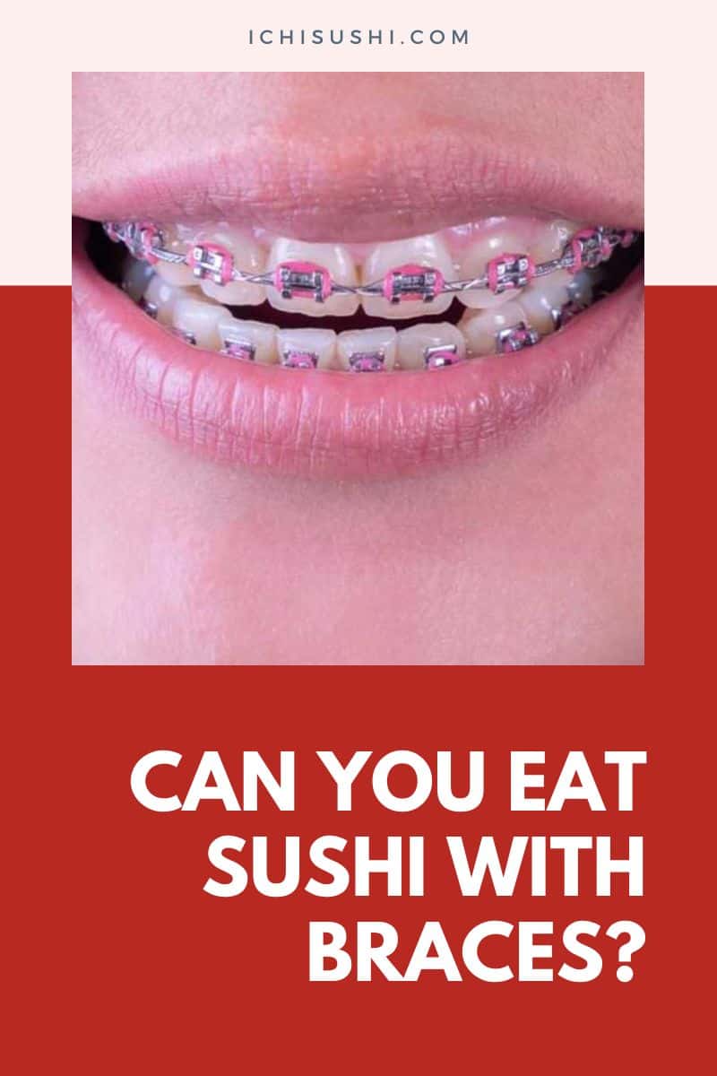 Can You Eat Sushi With Braces